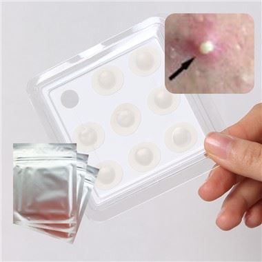 مہاسوں جگہ پیچ